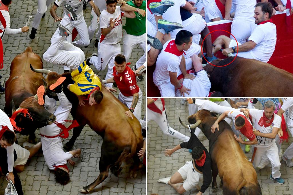 Şok edici fotoğraflar, bir Pamplona boğa koşusunda Floridalı bir adamın yırtık bacağını gösteriyor